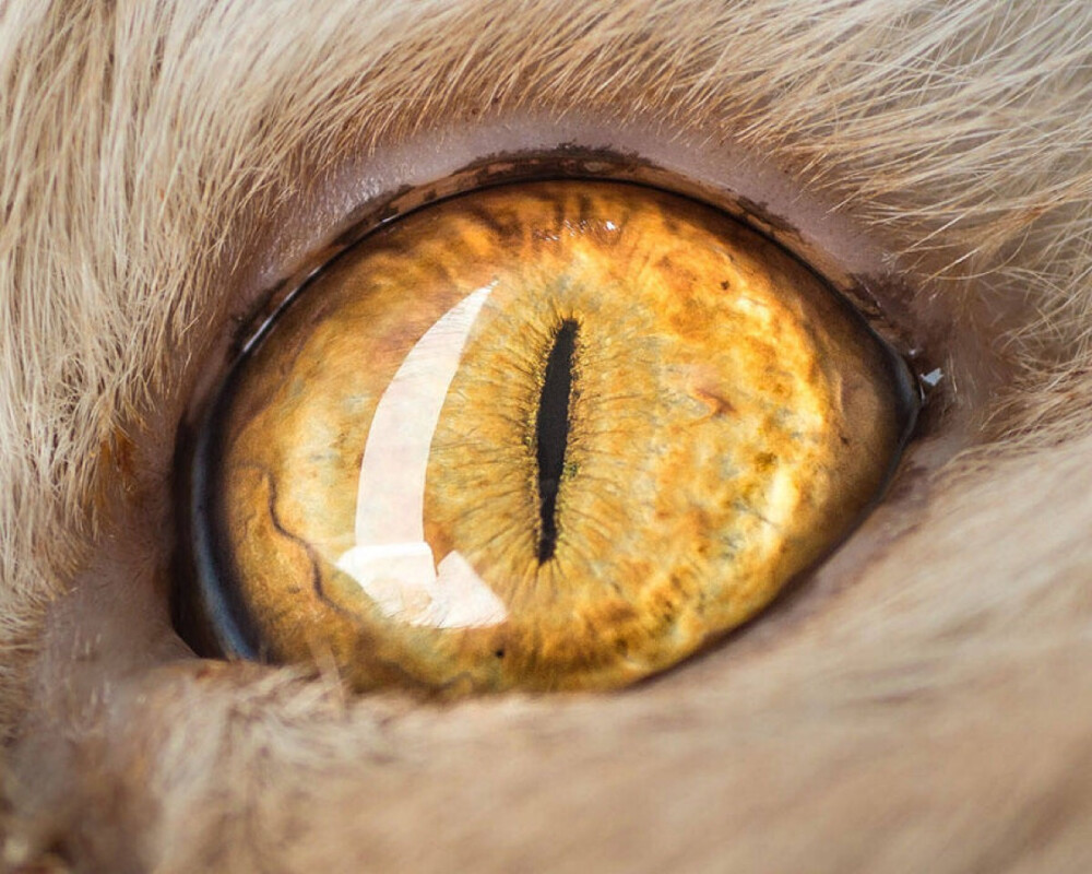 EYE