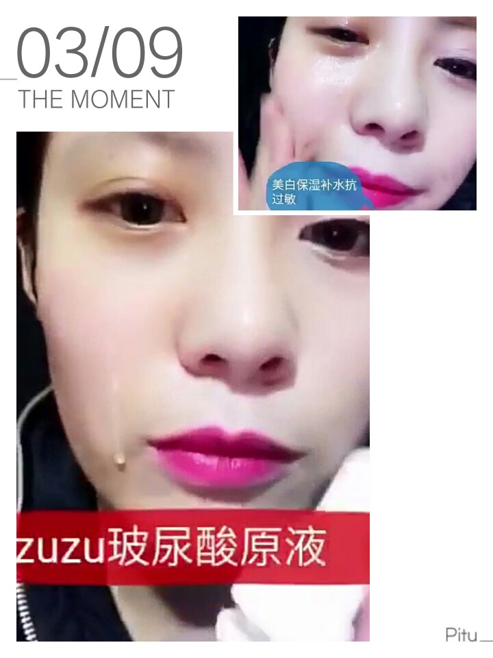 zuzu玻尿酸：【zuzu玻尿酸】为什么皮肤不好，看看自己占了几条？
✨第一：太懒[阴险]
✨第二：护肤意识太差[坏笑]
✨第三：想要最好的，又不想花钱[偷笑]
✨第四：不坚持，不按时，不补水，不防晒，不隔离，不卸妆
✨第五：宁愿粉底打的死厚，也不愿意补水保湿换一个滋润的皮肤
✨第六:宁愿花几千买个像素好的手机，也不愿买瓶玻尿酸改善自己的皮肤❗️