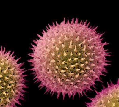 普通锦葵属植物（蔓锦葵）的花粉。
