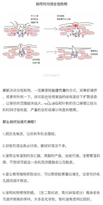 闭口大作战 超详细闭口粉刺科普种草贴 ​​​