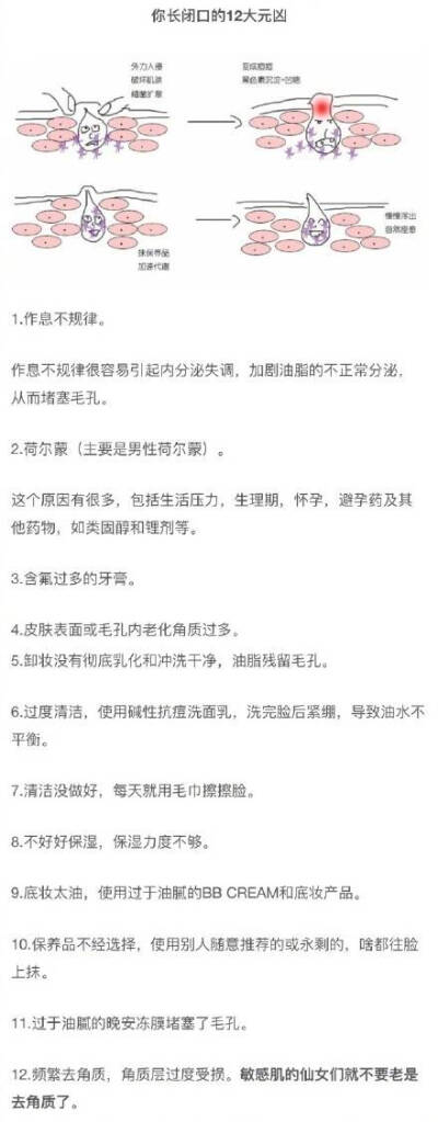 闭口大作战 超详细闭口粉刺科普种草贴 ​​​