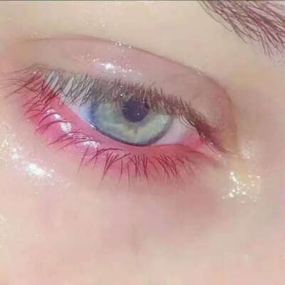 eye