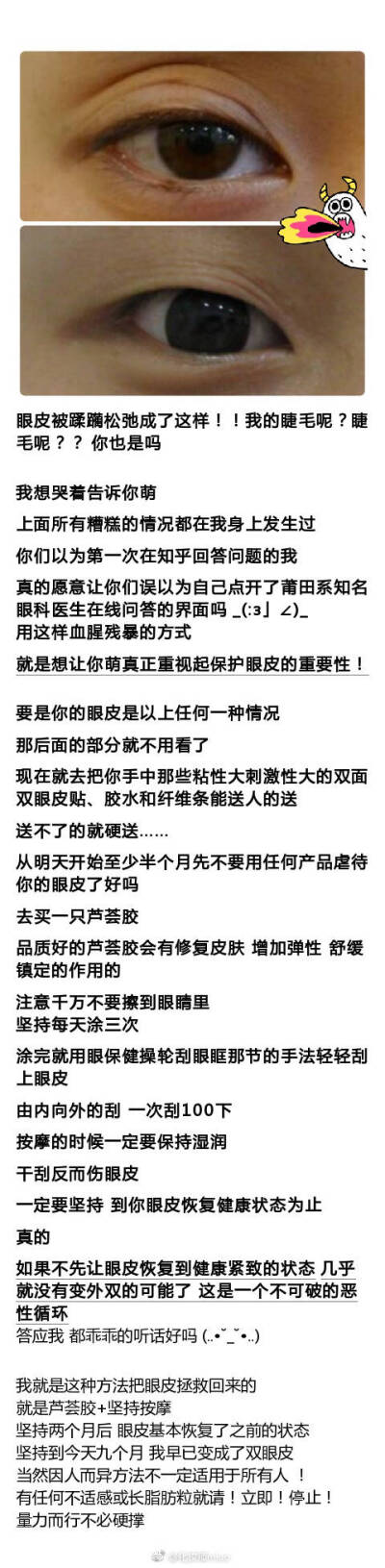 内双如何自然地变成双眼皮？
不伤眼部神经的 ​