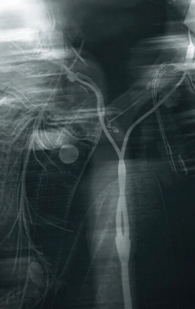 CT片子的既视感