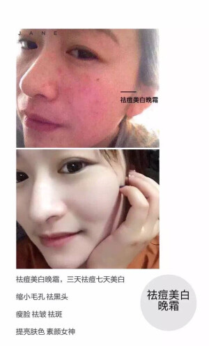 今日一学皮肤缺水，能引起许许多多的问题； 1：长痘痘，因为皮肤油水不平衡！ 2：起皮屑，因为皮肤太干燥，角质层脱落！ 3：干，痒，因为皮肤缺水，细胞得不到水份！ 4：容易过敏，因为细胞长时间得不到水份，毒素累积在皮下！ 5：长脂肪粒，因为护肤品营养吸收不了，细胞得不到水份，不能激活！ 6：皮肤暗黄不通透，因为细胞老化变异，细胞慢慢死去！ 等等一系列皮肤问题，都是由于缺水引起的