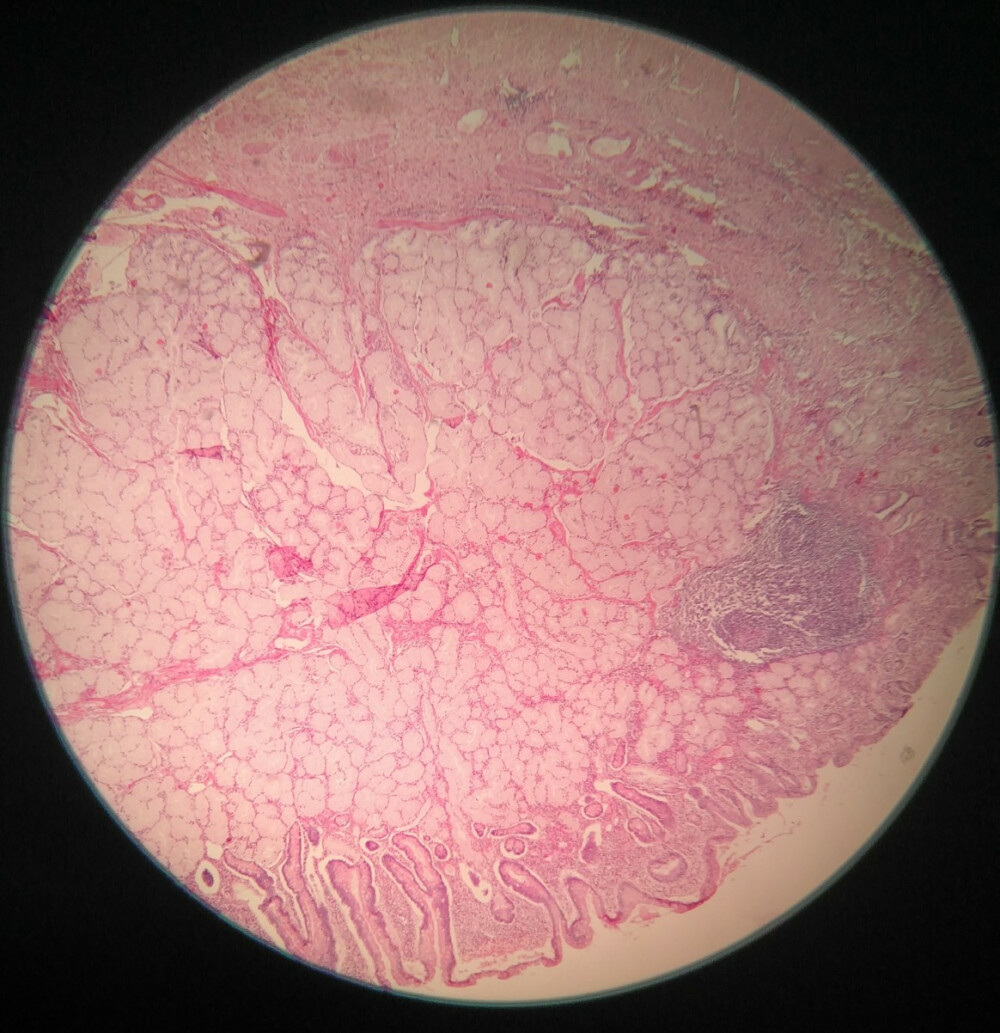 1010正常胃壁固有层