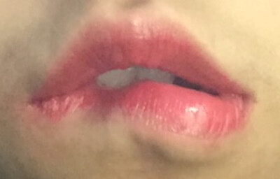 Lips 