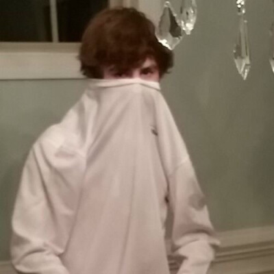 The burn marks on my Epiano wont go away
