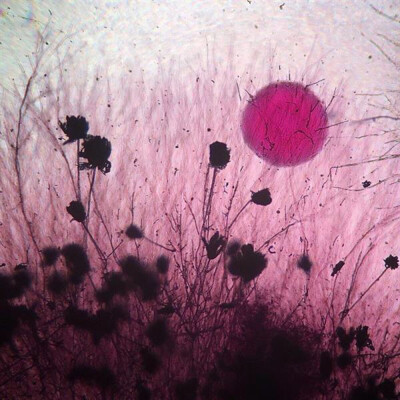 泥土中的Aspergillus flavus（一种真菌）和酵母型菌落