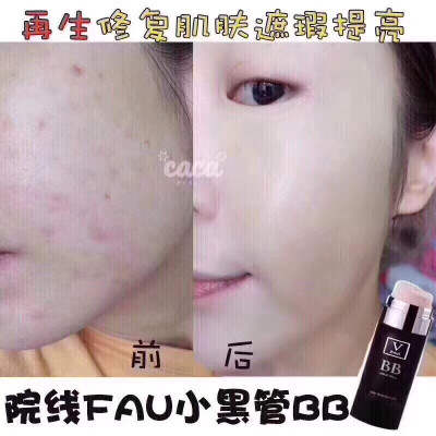 FAU黑管再生bb！啥叫再生？就是不单纯能遮瑕，提亮，就是还能修复你的皮肤，使你的皮肤再生❤️黑管BB❤️韩国再生医疗中心研发的FAU万能修复黑BB[奸笑] 绝对新欢 但是重复厚重的bb加上防晒会让毛孔堵塞！很多BB啊…