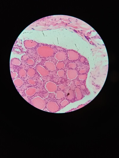 甲状腺滤泡 医学生专用头像 头像 我的大学