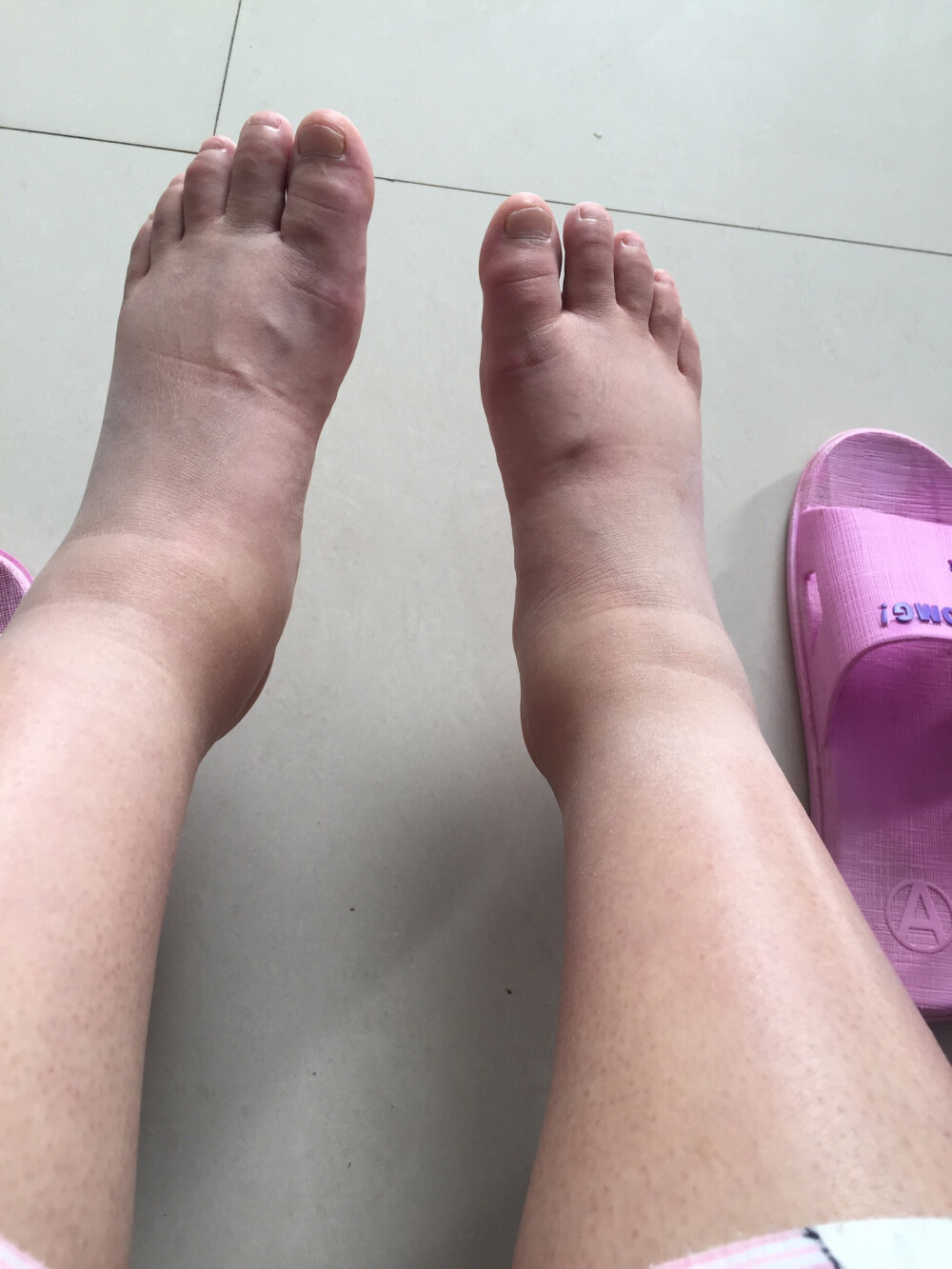 好公婆好老公都是别人家的,要生了小肚子疼,脚肿得跟面包一样,还得