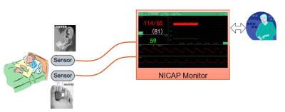 无创连续每搏动脉血压监测脉联医疗