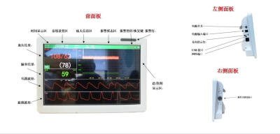 无创连续每搏动脉血压监测脉联医疗