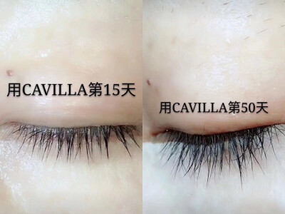 #Cavilla#睫毛增长液#用了一瓶睫毛长得又长又密。即使睫毛掉了重新长出来也比没用之前的长。现在完全不需要贴假睫毛和花钱去种睫毛。有时候化妆睫毛都可以省掉不刷。都是用了之后的反馈对比。