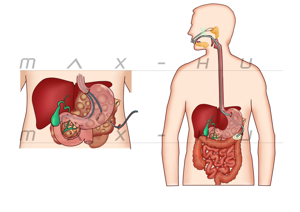 医学插画