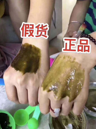 撕膜反馈
痘痘这个东西，你拖一天就严重一天，用手抠抠，用粉刺针扎扎，用点
去痘痘的药膏药水涂涂都不会干净，还会反复，那样只会耽误你治痘痘
的最佳时间。你必须要疏通毛孔，清洁干净毛孔才能达到根部治疗