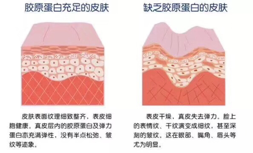 人体衰老的过程
就是胶原蛋白流失的过程！
胶原蛋白缺失
肌肤会出现皱纹、色斑、
暗淡等问题
大部分的肌肤问题
归根到底是
你体内的胶原蛋白正在流失