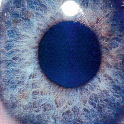 eye