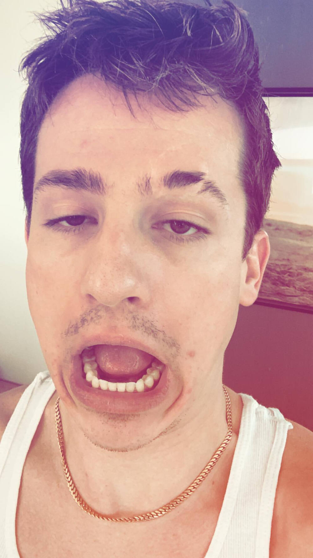 Charlie Puth 3/7「Instagram story」傻猹乱用脸