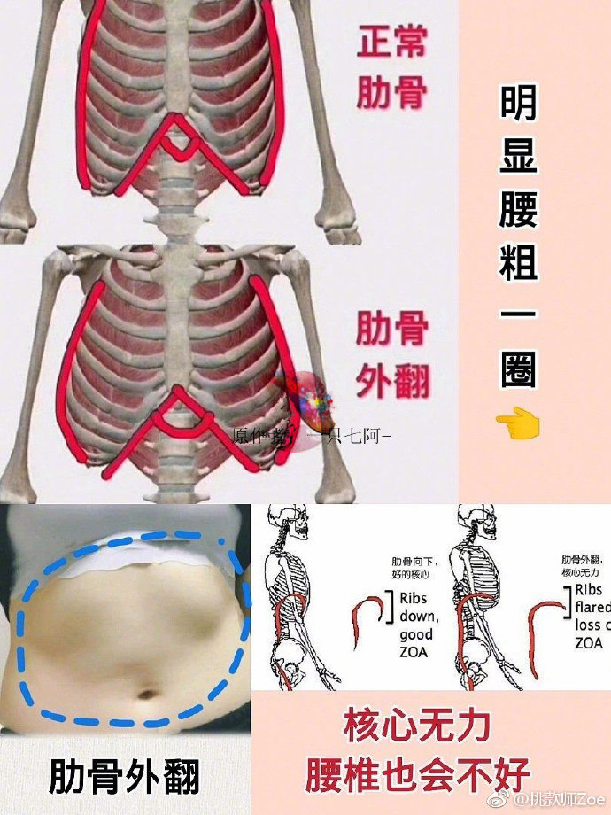 ㊙️懒人必学‼️超强呼吸法➕按摩‼️躺着get女友腹，小蛮腰‼️轻松解决山支大哥同款肋骨外翻‼️
⭕怎么判断自己肋骨外翻？
1⃣肚子向外突出显得腰围粗一圈
2⃣放松状态下肋骨超过身体边缘
如图上
⭕怎么瘦腰并且改善肋骨外翻？
1⃣抬手即收腹
不管是运动或生活，抬手时条件反射的收腹
不收腹手抬越高，腰顶的越厉害则越严重
2⃣做肋间呼吸
吸气时肋骨向上向外扩张
呼气时向下向内收
3⃣加强上腹部力量
2个动作，既能瘦腰腹，还能改善肋骨外翻，做法注意事项图片有啦～
⭕睡前2个瘦腰穴位！
中脘穴
关元穴
2个按摩
⭕穴位每天睡前按，10天就能感觉到变化，还能缓解便秘，除了按摩瘦腰之外，饮食也是有必要的。