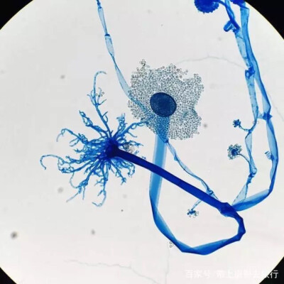 共头霉在显微镜下看起来就像是一朵花