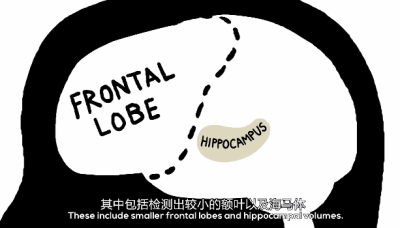 『TED-Ed』Depression ​​​​