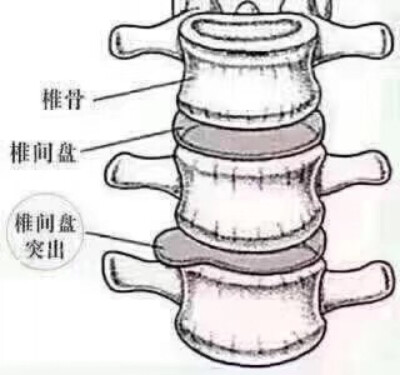 【肾虚为何会腰痛？】
跟大家科普一下：腰痛是肝不藏血，血不养筋。根本原因是肾虚了。
肾主骨生髓，所以肾虚营养不能很好的供给骨髓，骨髓造血就少了。造出来的血少了肝藏血自然而然也就少了，腰上两大筋得不到充足…