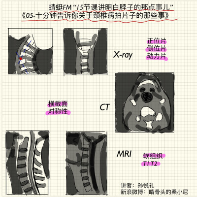 关节