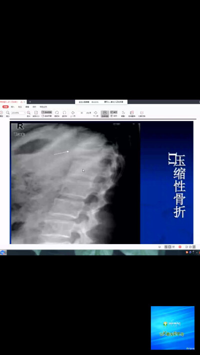 辅助检查影像学x线