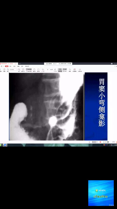 辅助检查影像学x线