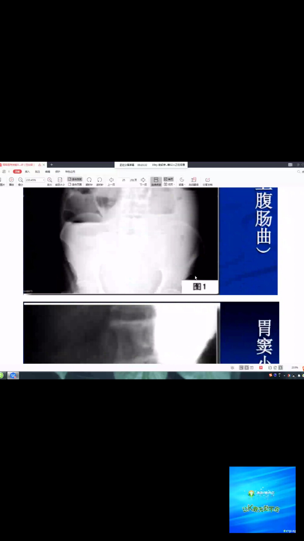 辅助检查影像学x线