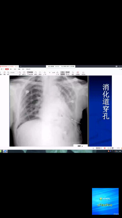 辅助检查影像学x线