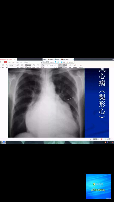 辅助检查影像学x线