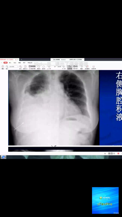 辅助检查影像学x线