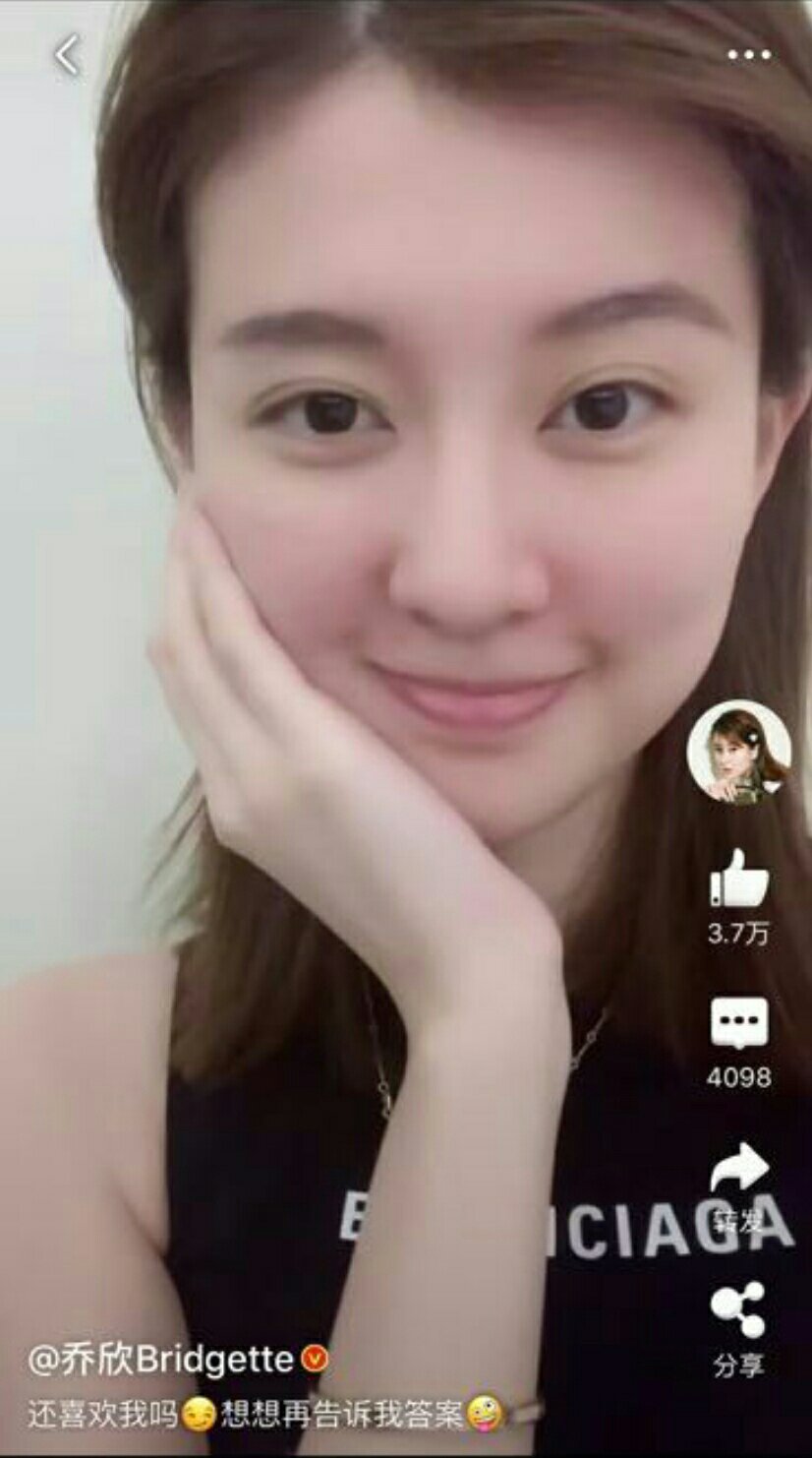 乔欣拔完智齿后#拔完智齿真的这么肿吗?