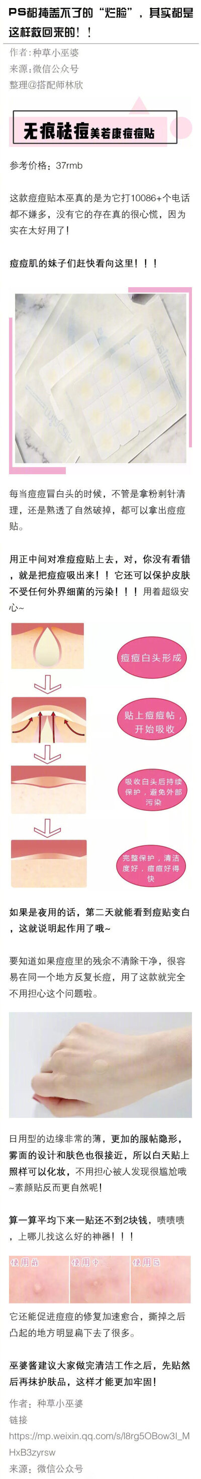 有哪些拯救闭口和痘痘的神器？ ​