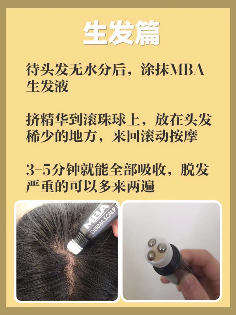 这是最良心的生发经验贴！！还不生发你找我！！
 
作为一个脱发四五年的人，一路上经历了否认、焦虑、自卑、坚持，抗脱，秃头初见成效的我有话说：
 
下面是关于防脱生发的20条建议！！尝试坚持下来绝对会出新头发哦！！