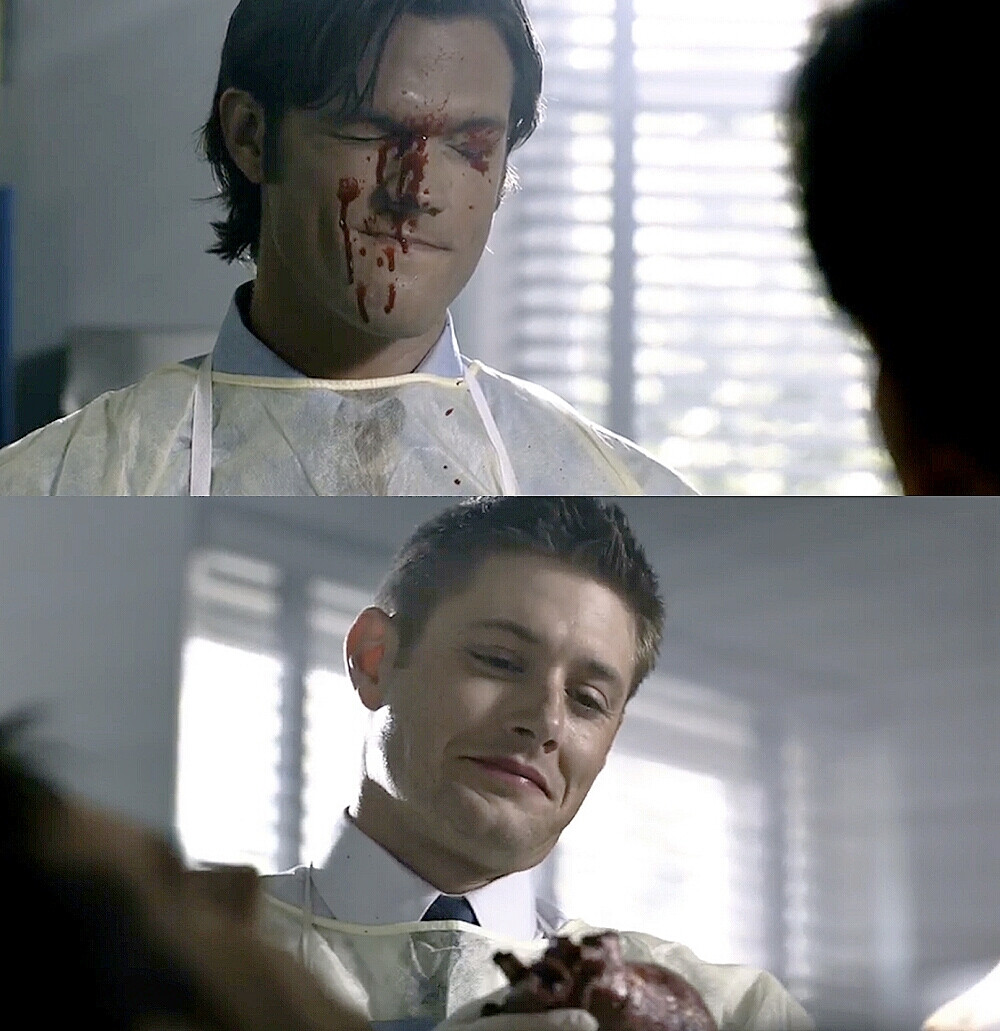 spn#supernatural J2