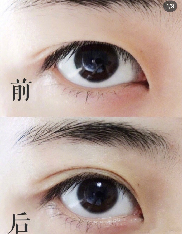 ✨内双变外双|消肿眼皮眼部穴位按摩方法✨以下按摩方法需搭配眼霜使用。每个按摩动作每次三组，早晚各一次。不要来回涂抹眼霜，而是要顺着同一个方向涂抹，不然反而容易长细纹。1️⃣图中标明的穴位每个穴位按压三次，每次三组，早晚各一次。2️⃣将掌心搓热，热敷眼部并停留半分钟，这样可以促进眼霜吸收以及缓解眼部疲劳。3️⃣用中指和无名指由下眼眶到，上眼眶最后到太阳穴画圈，记得动作要缓慢并稍微用力。4️⃣将大拇指置于太阳穴，用食指关节刮上下眼眶，记得刮.上眼眶时到达眉尾位置要往上刮。5️⃣用食指和中指将眼尾撑开，然后用另一只手的食指和中指轻轻向.上推眼尾，这个动作可以预防和消除鱼尾纹。6️⃣用食指