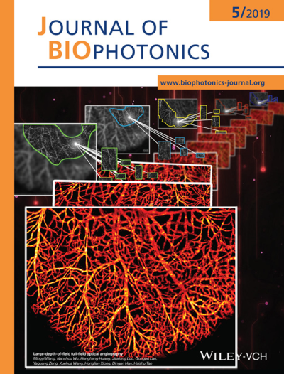 Journal of Biophotonics 佛山科学技术学院科研绘图画图SCI杂志期刊封面图流程图示意图摘要图TOC绘制
邦图科研绘图构图画图SCI期刊三维摘要图TOC封面设计
国外科研SCI文章绘图PS电镜图医学动画期刊杂志封面TOC设计…