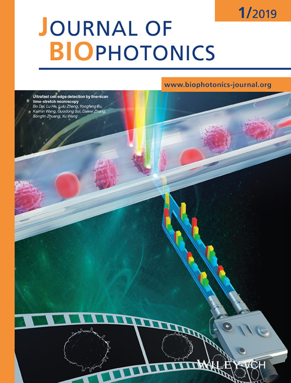 Journal of Biophotonics 上海理工科研论文配图、科研绘图公司、学术期刊杂志封面、医学插画公司
sci论文配图设计、医学科研绘图、学术杂志封面、医学图书插画
科技论文配图、科研绘图培训、外文学术杂志封面、上海医学插画公司
论文配图公司、
3dmax科研绘图毕业论文配图学术期刊封面设计科研绘图医学插画
科研绘图SCI画图学术杂志封面设计TOC示意图文章配图医学动画
杂志封面设计科研作图SCI画图TOC示意图学术文章配图
论文配图杂志封面设计科研绘图sci医学插画三维动画综述图