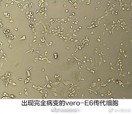 【#广东首株新型冠状病毒毒株成功分离#】今天，广东省疾病预防控制中心成功分离出广东省第一株新型冠状病毒（2019-nCoV）毒株，这是从一例病例的肺泡灌洗液中分离出来的，使用了vero-E6传代细胞系。#最新疫情地图#，中国除了西藏各省直辖市都有了 #深圳又一例确诊病例治愈出院#