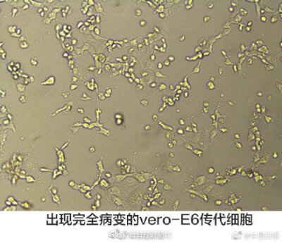 【#广东首株新型冠状病毒毒株成功分离#】今天，广东省疾病预防控制中心成功分离出广东省第一株新型冠状病毒（2019-nCoV）毒株，这是从一例病例的肺泡灌洗液中分离出来的，使用了vero-E6传代细胞系。#最新疫情地图#，…