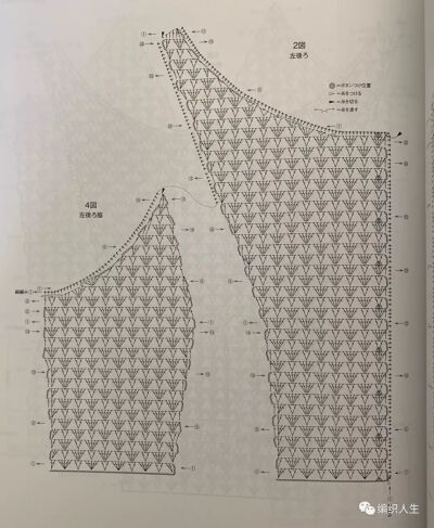 蕾丝上衣