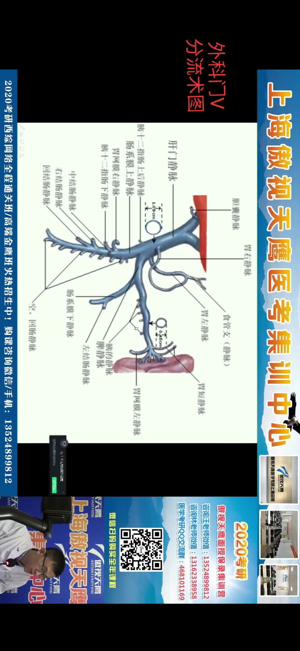 肝脏血流走向图图片