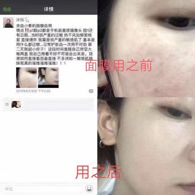 面膜反馈 效果是真的好的没话说，效果不好也不会有这么多人买我家产品