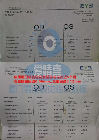 爱睛喜，哺光仪，智能视力健康仪，哺光仪有效果吗？答案。